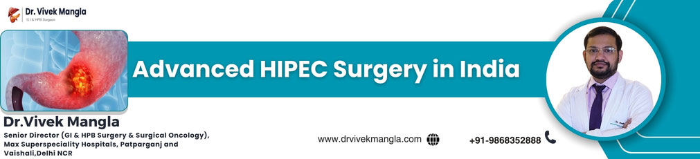 Advanced HIPEC Surgery in India
