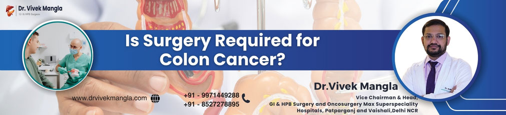 Is surgery required for colon cancer?