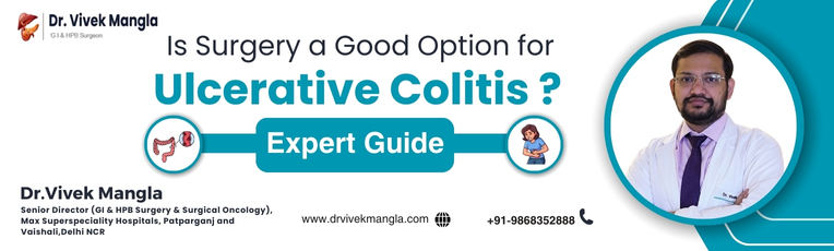 Is Surgery a Good Option for Ulcerative Colitis?