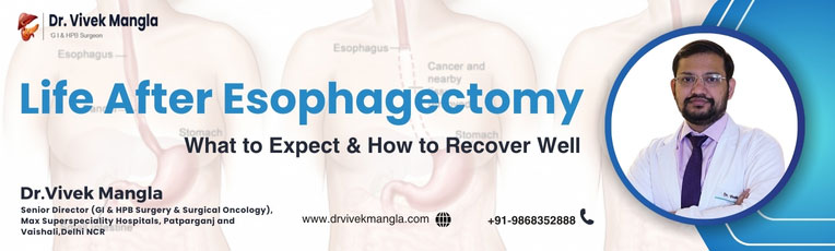 Life After Esophagectomy Surgery